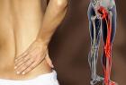 Điêu Trị Đau Thần Kinh Tọa Tại Chuyên Khoa Việt Đức Ba Đình